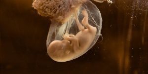 Welche Faktoren Einfluss auf die Entwicklung des Embryos haben