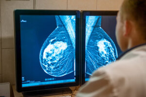 Brustkrebs und Fruchtbarkeit: Was junge Patientinnen heute wissen sollten 1