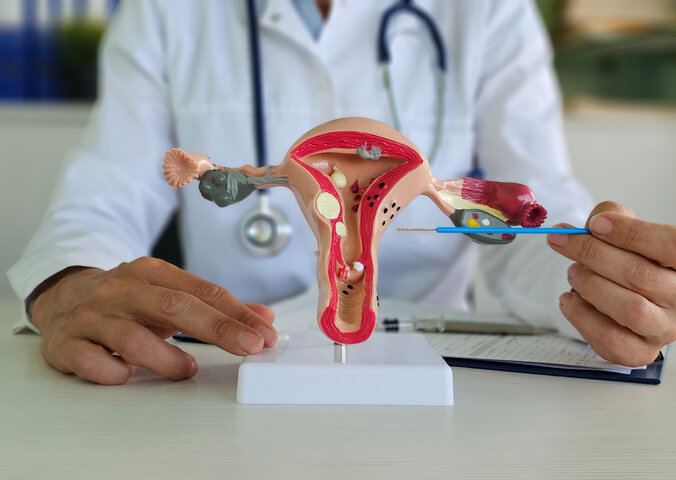 Studie zeigt: Das Mikrobiom der Gebärmutter könnte den Erfolg einer IVF beeinflussen 4 Studie zeigt: Das Mikrobiom der Gebärmutter könnte den Erfolg einer IVF beeinflussen 4