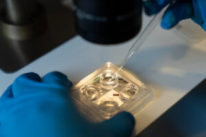 IVF oder ICSI: Ist die aufwendigere Behandlung wirklich besser? 1