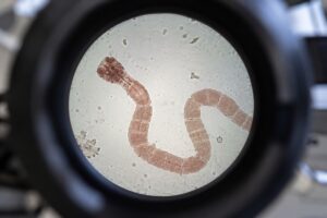 Endometriose und Kinderwunsch: Umgebautes Wurmmittel zeigt vielversprechende Wirkung im Tierversuch 1